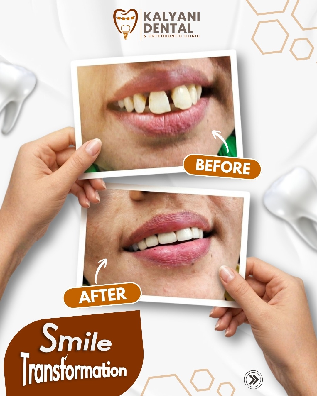 Real Smile Transformation