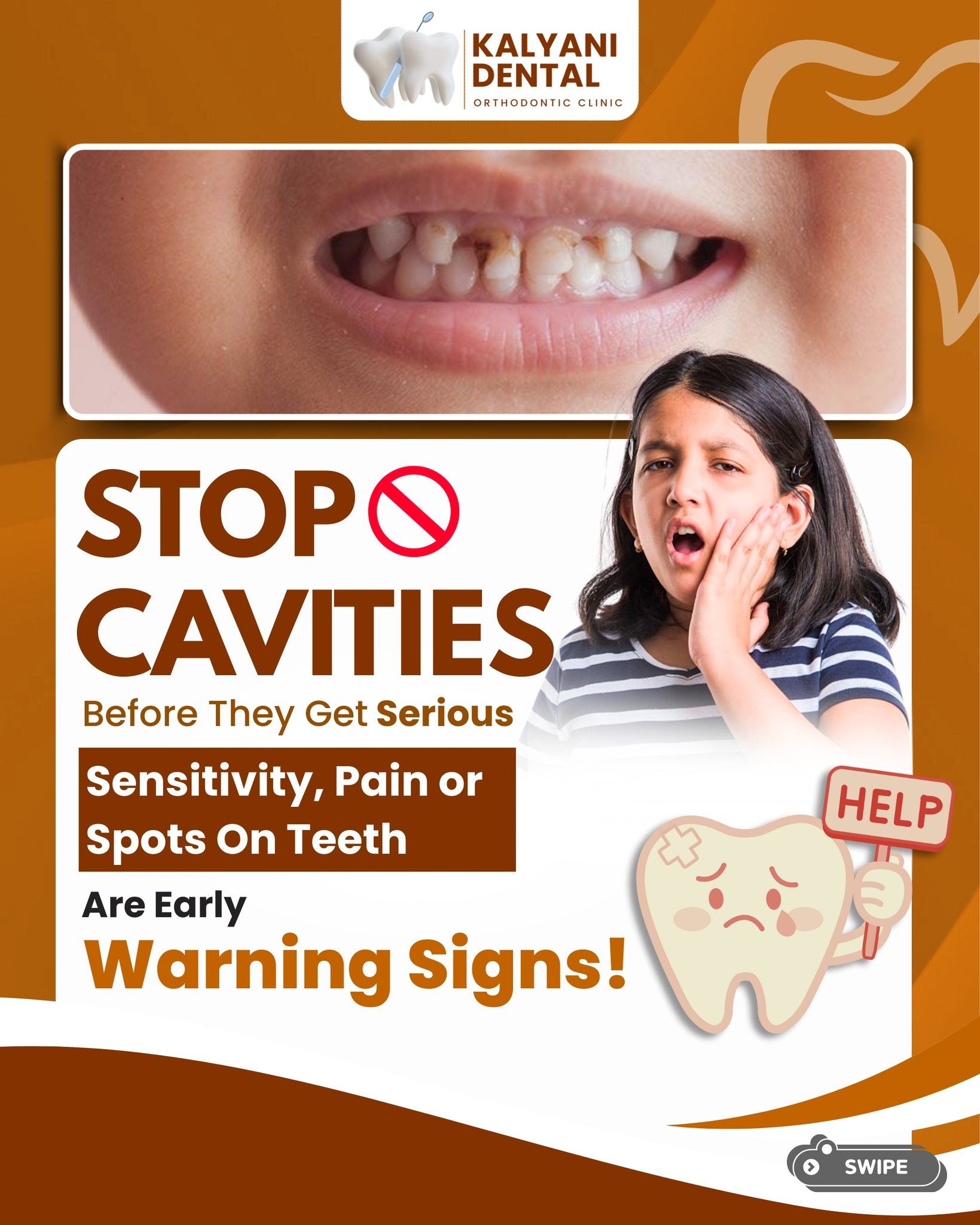 Don’t Ignore Early Signs of Cavities