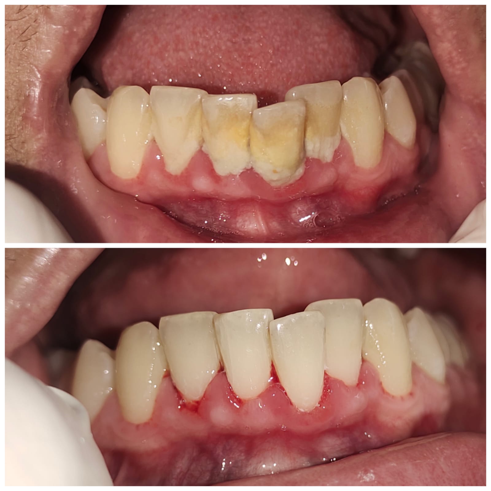 Before After